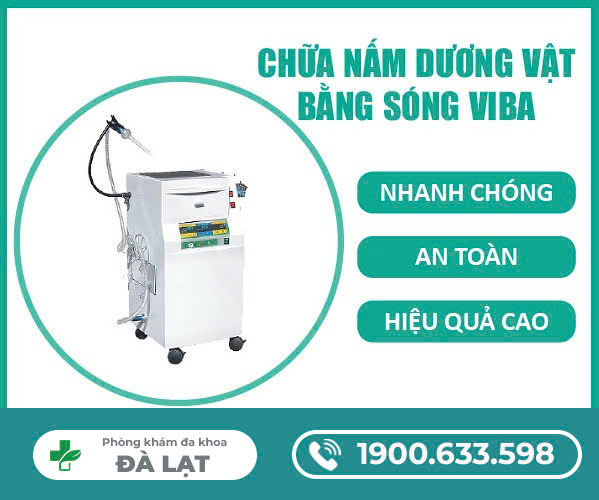 Hình ảnh minh họa